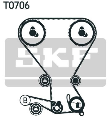 Zobsiksnas komplekts VKMA95658